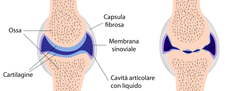 ORTOPEDIA