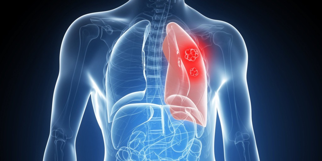 PNEUMOLOGIA