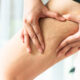 Trattamento Cryo t-shock Famagosta