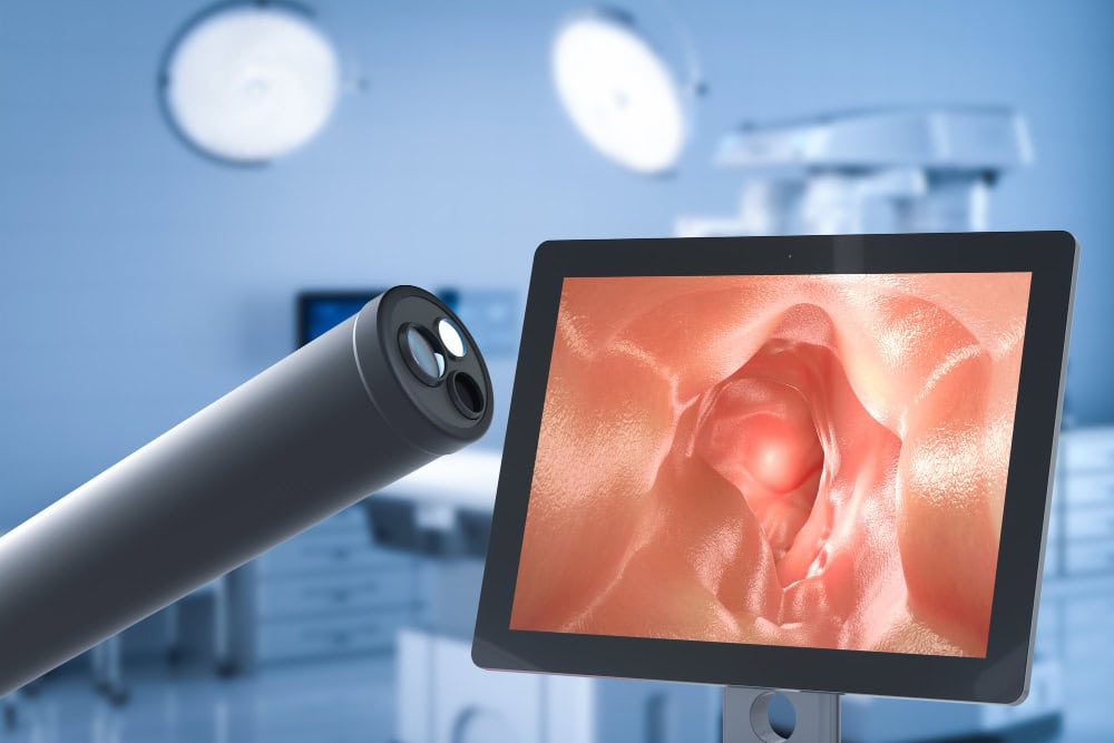 Dove fare la fibroscopia a Milano?